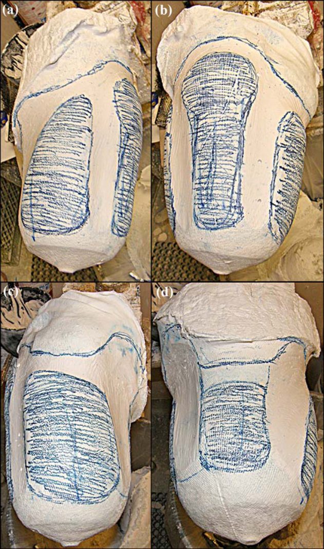 Rectified transfemoral plaster models marked with compression and release areas