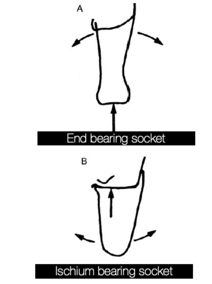 Diagram comparing an end-bearing KD socket with an ischium-bearing socket
