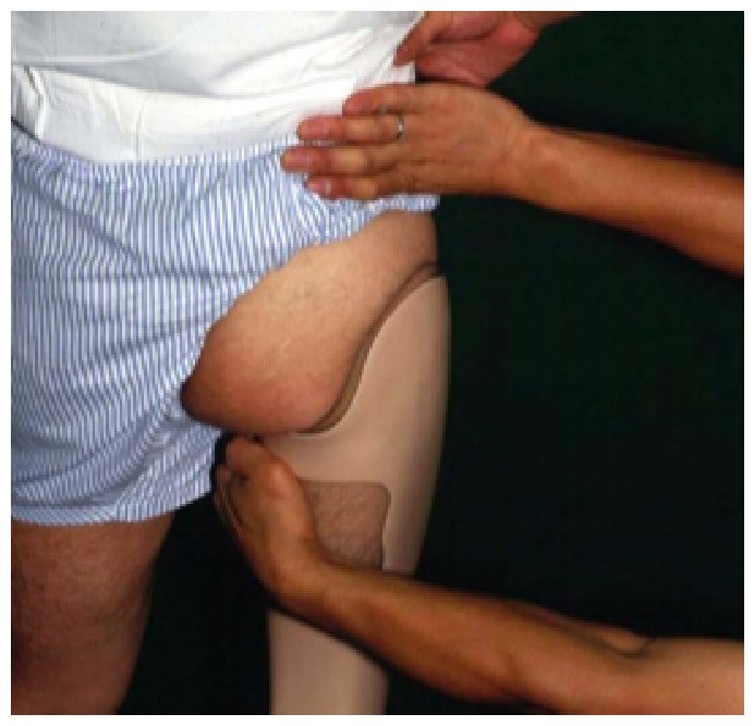 Hands testing a socket with a bony lock