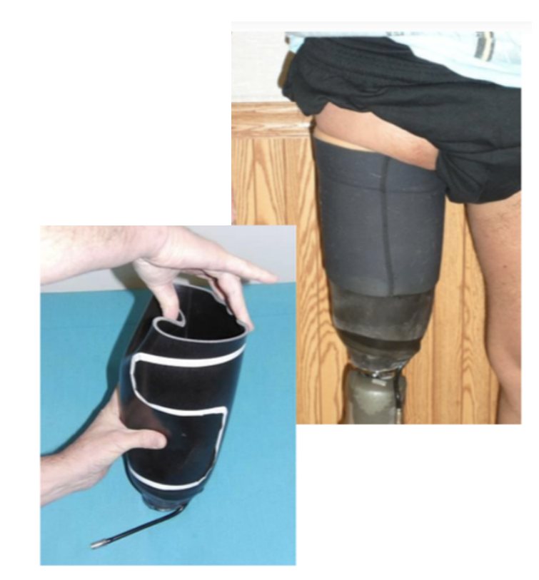 NU-FlexSIV subischial socket with flexible inner socket