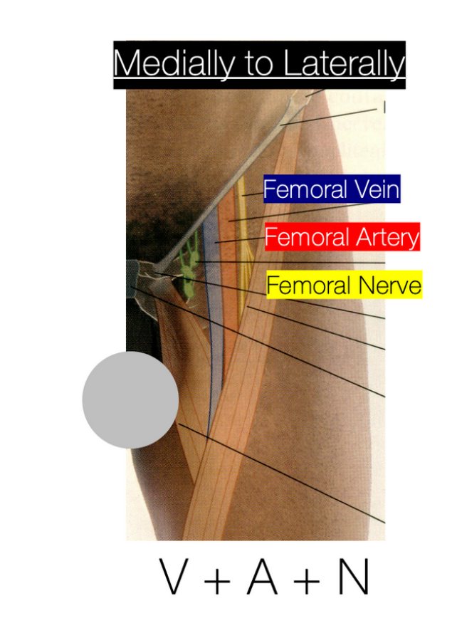 Front of the thigh showing the femoral vein, artery and nerve in Scarpa's triangle