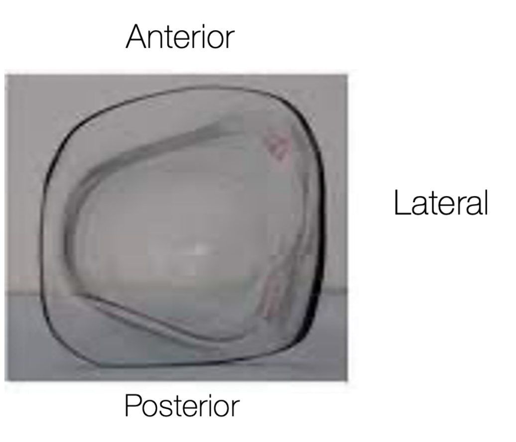 QL socket seen from above with anterior, posterior, medial and lateral labels